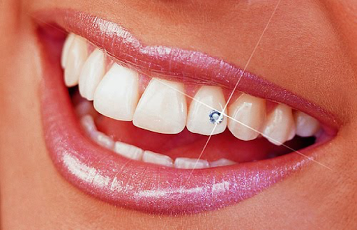 Teeth jewellery: