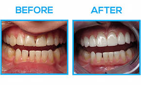 Cosmetic Dentistry: