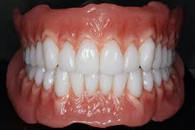 Dentures (Fixed & Removable) :